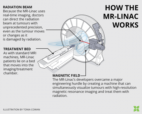 How the MR-LINAC works