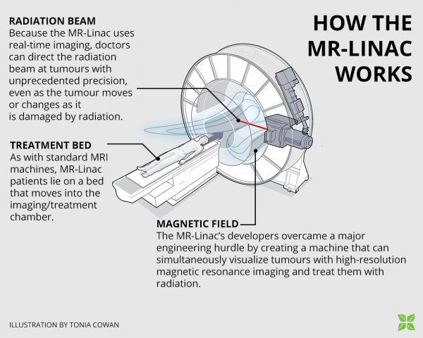 Fonctionnement du MR-LINAC